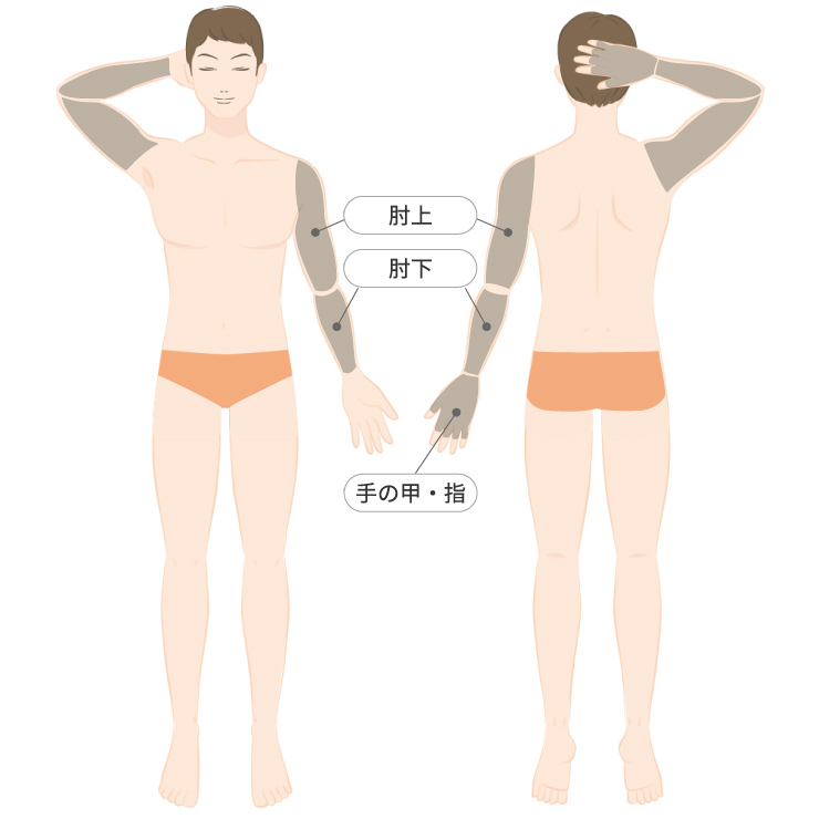 腕全体脱毛プラン