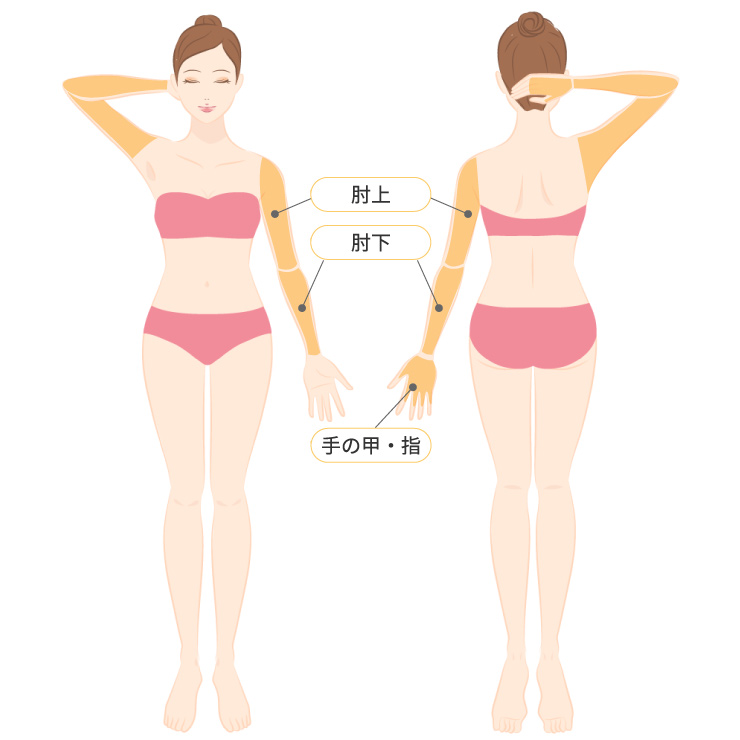 腕全体脱毛プラン