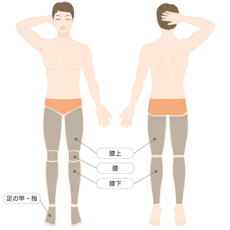 脚全体脱毛プラン